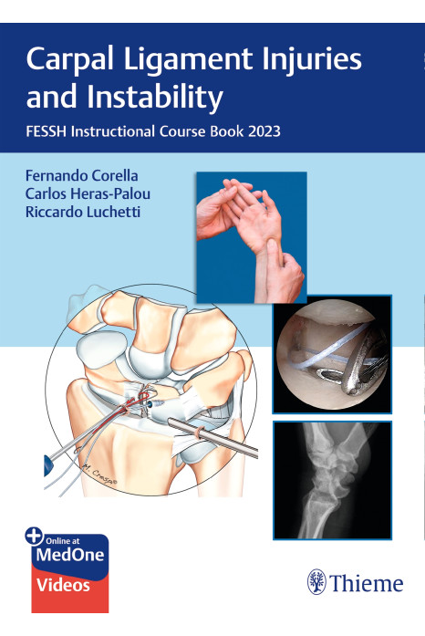 Carpal Ligament Injuries and Instability