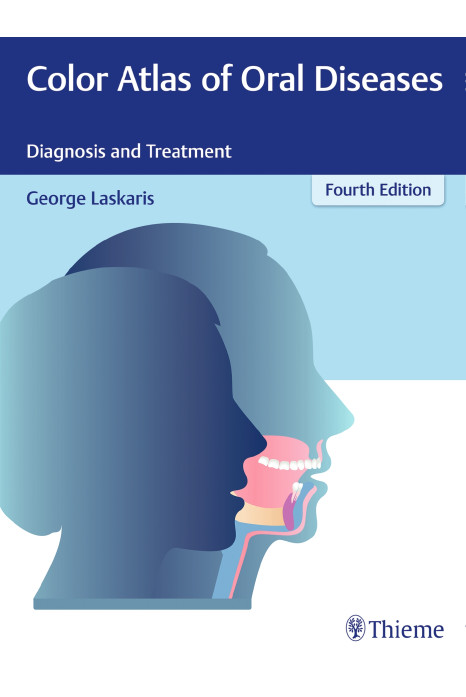 Color Atlas of Oral Diseases