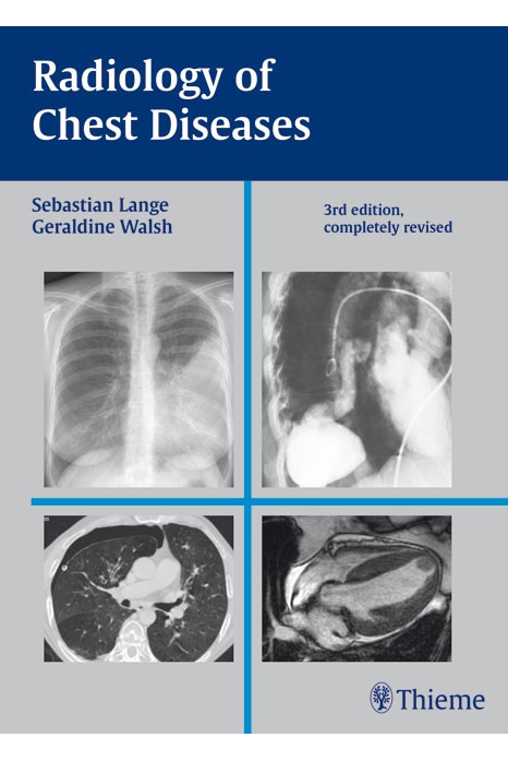 Radiology of Chest Diseases