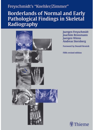 Freyschmidt's "Koehler/Zimmer" Borderlands of Normal and Early Pathological Findings in Skeletal Radiography