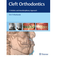 Cleft Orthodontics