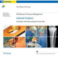 AO Manual of Fracture Management