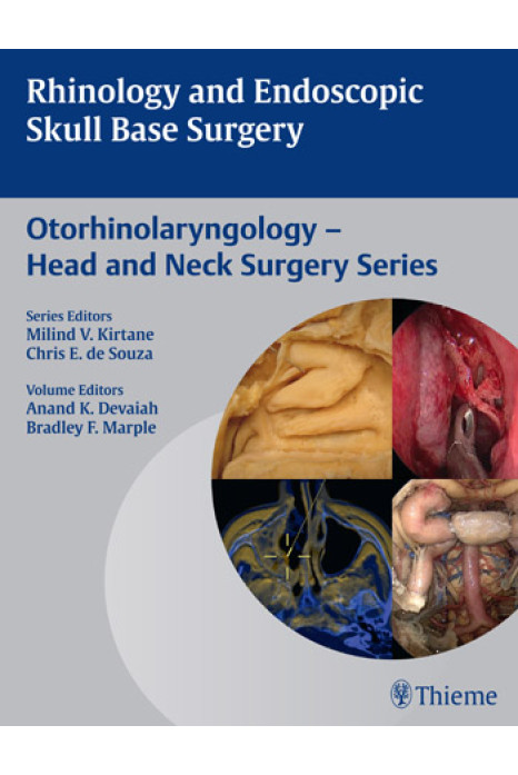 Rhinology and Endoscopic Skull Base Surgery