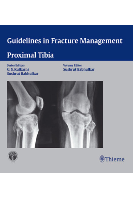Guidelines in Fracture Management