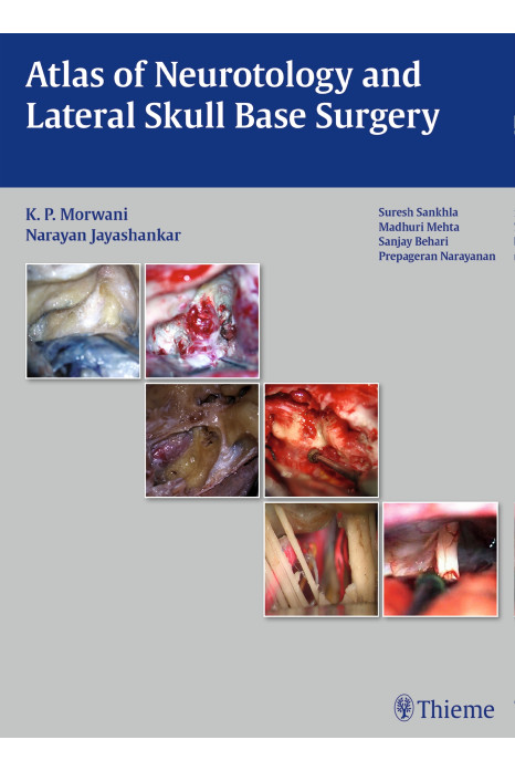 Atlas of Neurotology and Lateral Skull Base Surgery