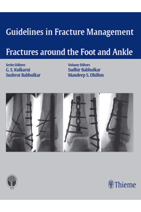 Guidelines in Fracture Management