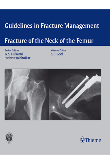 Guidelines in Fracture Management