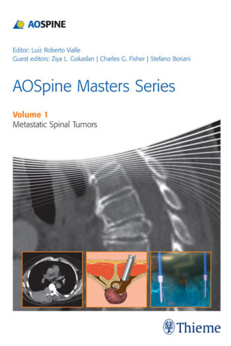 AOSpine Masters Series Volume 1