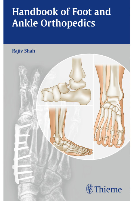 Handbook of Foot and Ankle Orthopedics