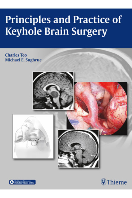 Principles and Practice of Keyhole Brain Surgery