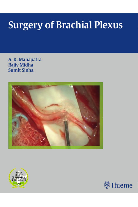 Surgery of Brachial Plexus