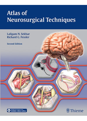 Atlas of Neurosurgical Techniques