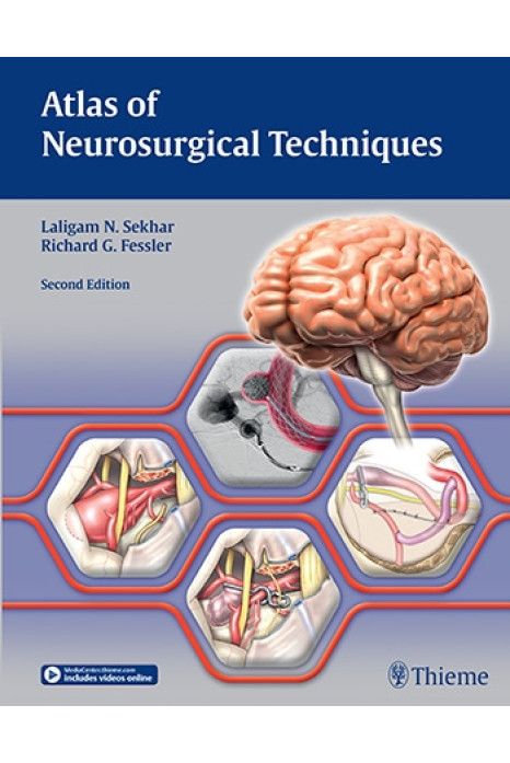 Atlas of Neurosurgical Techniques
