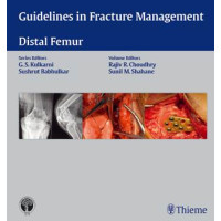 Guidelines in Fracture Management