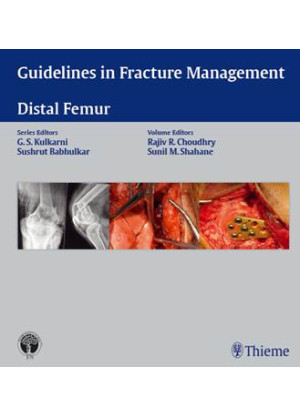 Guidelines in Fracture Management