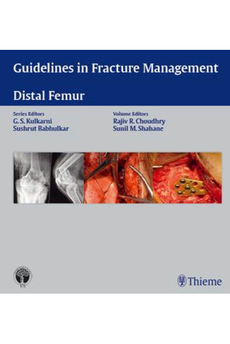 Guidelines in Fracture Management