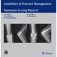 Guidelines in Fracture Management