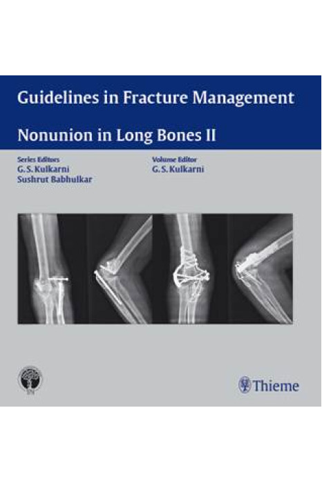Guidelines in Fracture Management