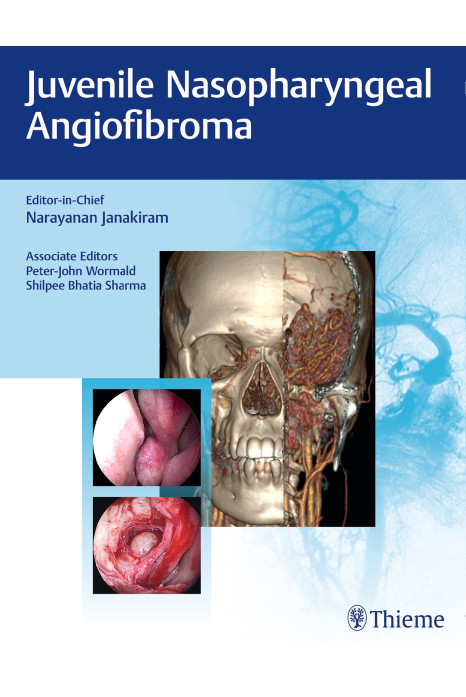 Juvenile Nasopharyngeal Angiofibroma
