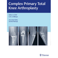 Complex Primary Total Knee Arthroplasty