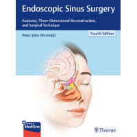 Endoscopic Sinus Surgery