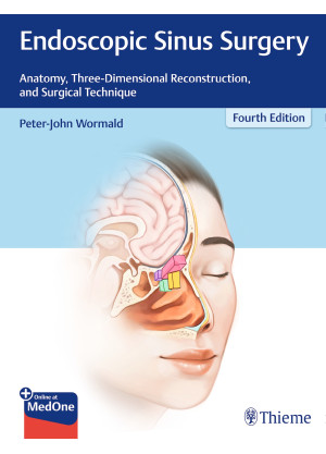 Endoscopic Sinus Surgery