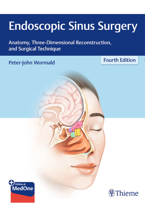 Endoscopic Sinus Surgery