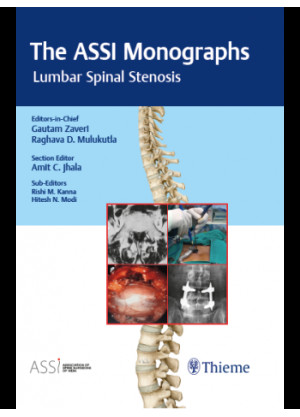 The ASSI Monographs-Lumbar Spinal Stenosis