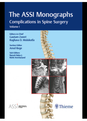 The ASSI Monographs-Complications in Spine Surgery