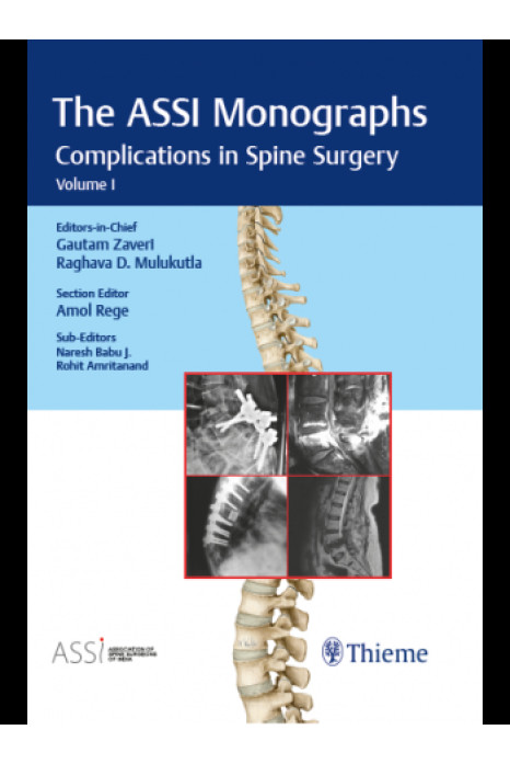 The ASSI Monographs-Complications in Spine Surgery