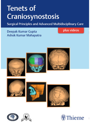 Tenets of Craniosynostosis