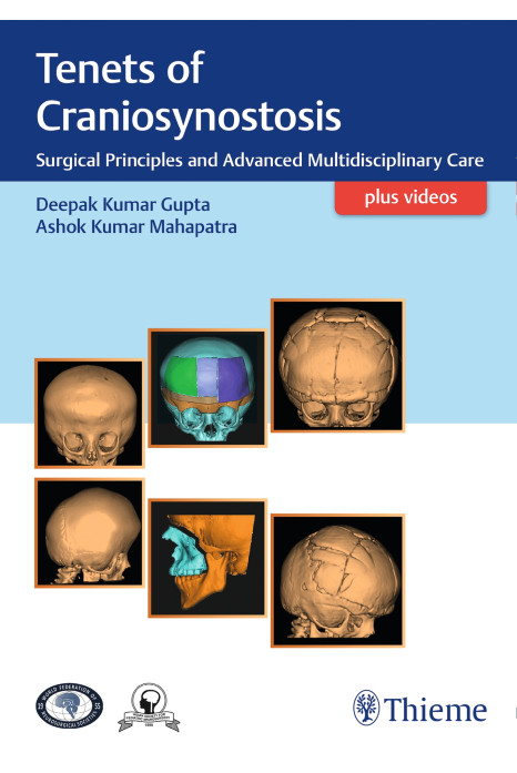 Tenets of Craniosynostosis