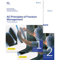 AO Principles of Fracture Management