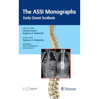 The ASSI Monographs—Early Onset Scoliosis