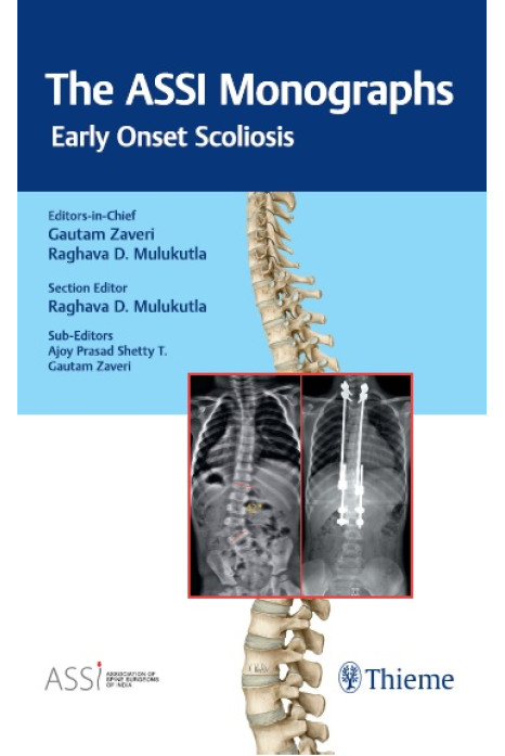 The ASSI Monographs—Early Onset Scoliosis