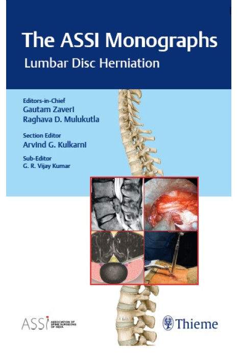 The ASSI Monographs—Lumbar Disc Herniation