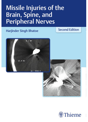 Missile Injuries of the Brain, Spine, and Peripheral Nerves