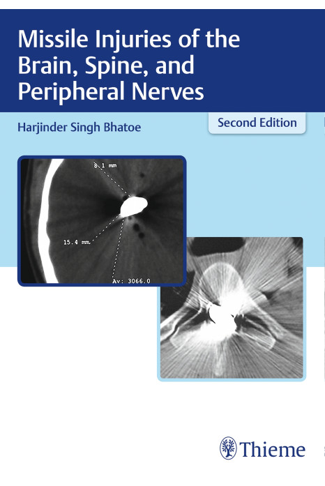 Missile Injuries of the Brain, Spine, and Peripheral Nerves