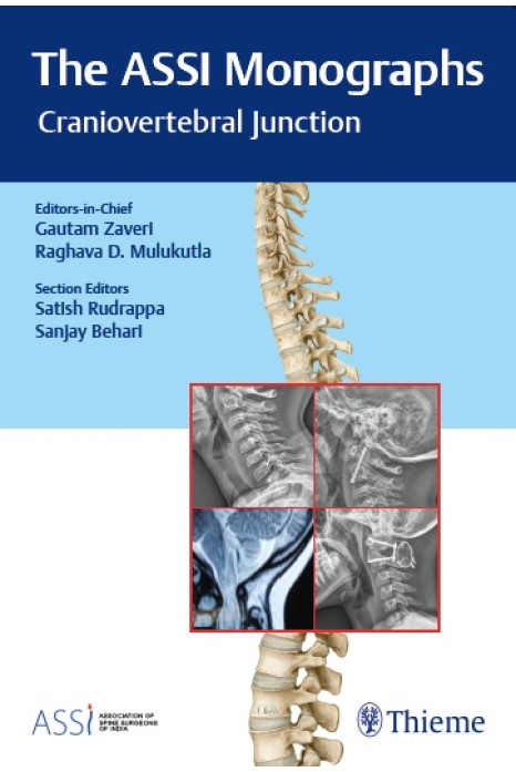 The ASSI Monographs—Craniovertebral Junction