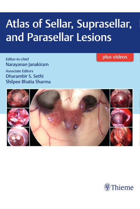 Atlas of Sellar, Suprasellar, and Parasellar Lesions