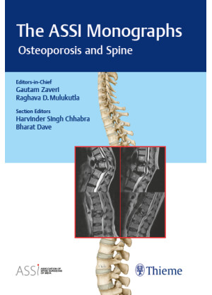 The ASSI Monographs - Osteoporosis and Spine