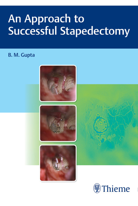 An Approach to Successful Stapedectomy