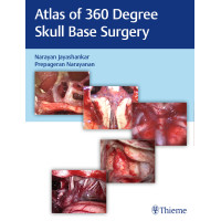 Atlas of 360 Degree Skull Base Surgery