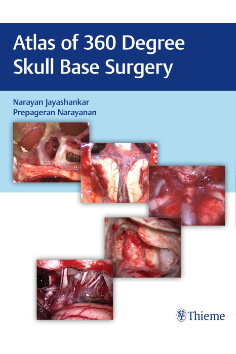 Atlas of 360 Degree Skull Base Surgery