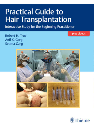 Practical Guide to Hair Transplantation