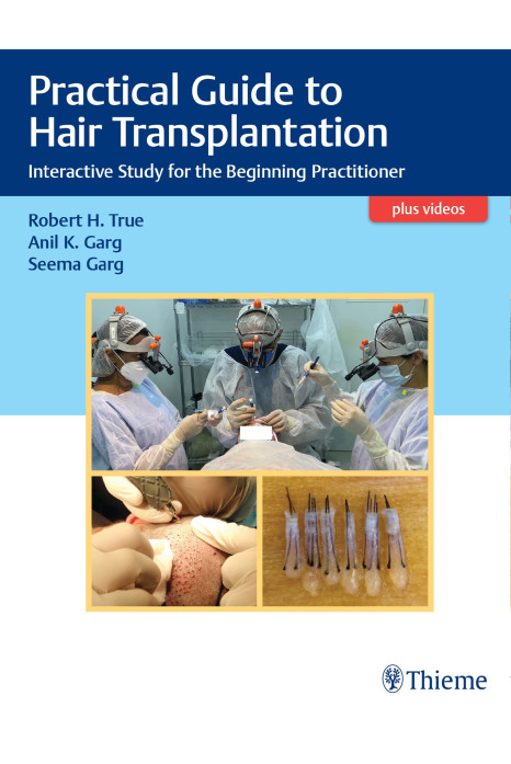 Practical Guide to Hair Transplantation