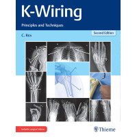 K-Wiring