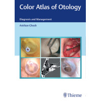 Color Atlas of Otology