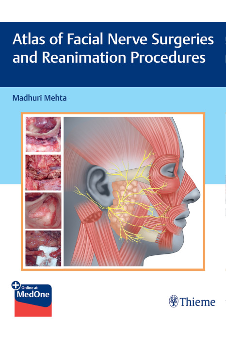 Atlas of Facial Nerve Surgeries and Reanimation Procedures