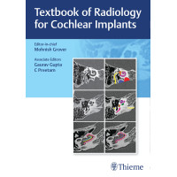 Textbook of Radiology for Cochlear Implants